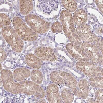 Immunohistochemistry: CTU1 Antibody [NBP2-47500]