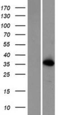 Western Blot: CTU1 Overexpression Lysate [NBP2-05488]