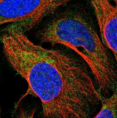 Immunocytochemistry/ Immunofluorescence: CTU2 Antibody [NBP1-88457]