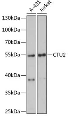 Western Blot: CTU2 AntibodyAzide and BSA Free [NBP2-92099]