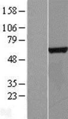 Western Blot: CTU2 Overexpression Lysate [NBL1-08230]