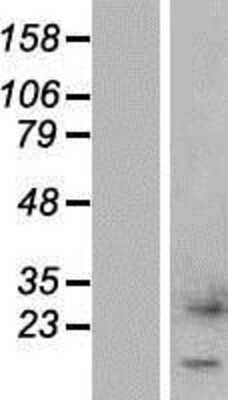 Western Blot: CTXN1 Overexpression Lysate [NBP2-04540]