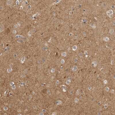 Immunohistochemistry-Paraffin: CUEDC1 Antibody [NBP1-86409]