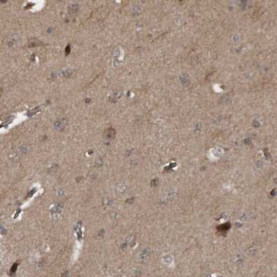 Immunohistochemistry-Paraffin: CUEDC1 Antibody [NBP1-86417]