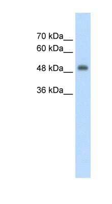 Western Blot: CUEDC1 Antibody [NBP1-57682]