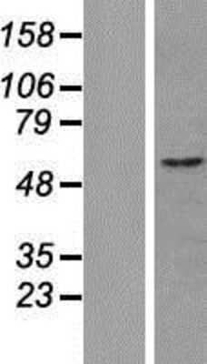 Western Blot: CUEDC1 Overexpression Lysate [NBP2-06897]