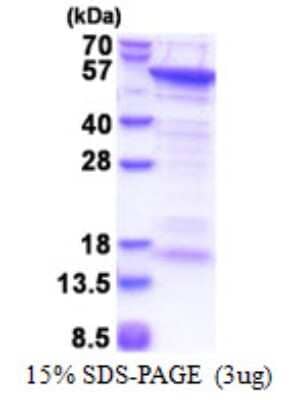 SDS-PAGE: Recombinant Human CUEDC1 His Protein [NBP2-22967]