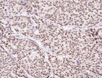 Immunohistochemistry-Paraffin: CUEDC2 Antibody (003) [NBP2-89902]