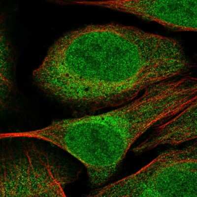 Immunocytochemistry/ Immunofluorescence: CUEDC2 Antibody [NBP2-58980]