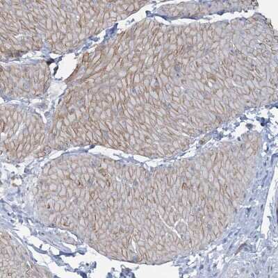 Immunohistochemistry-Paraffin: CUEDC2 Antibody [NBP1-88538]