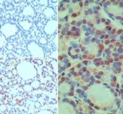 Immunohistochemistry-Paraffin: CUEDC2 Antibody [NBP2-24684]