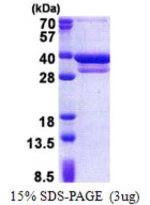 SDS-PAGE: Recombinant Human CUEDC2 His Protein [NBP2-22968]