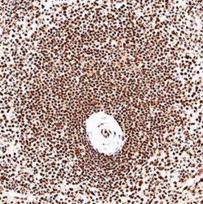 Immunohistochemistry-Paraffin: CUGBP1/CELF1 Antibody (3B1) [NB200-316]