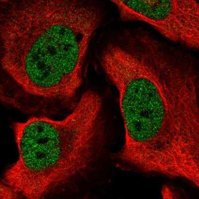 Immunocytochemistry/ Immunofluorescence: CUGBP1/CELF1 Antibody [NBP2-76536]