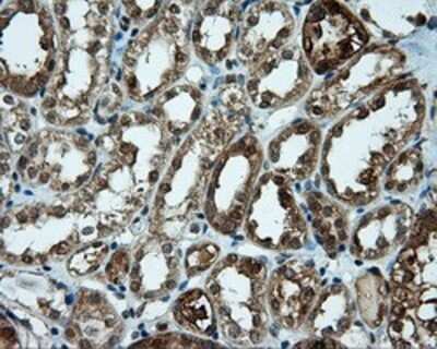 Immunohistochemistry: CUGBP1/CELF1 Antibody (OTI5B8) - Azide and BSA Free [NBP2-71623]
