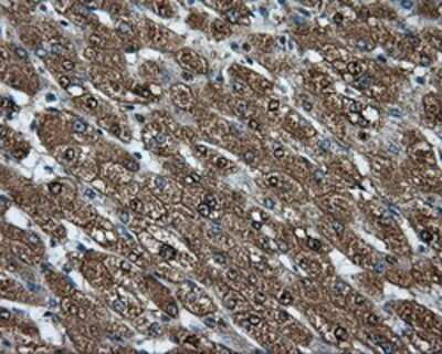 Immunohistochemistry: CUGBP1/CELF1 Antibody (OTI5B8) - Azide and BSA Free [NBP2-71623]