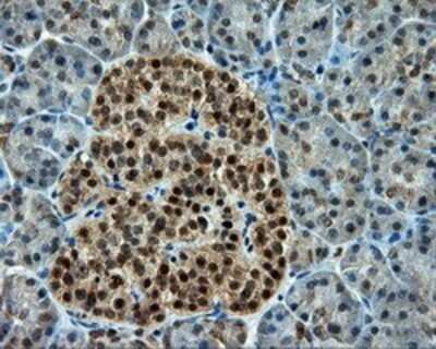 Immunohistochemistry: CUGBP1/CELF1 Antibody (OTI5B8) - Azide and BSA Free [NBP2-71623]