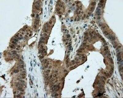 Immunohistochemistry-Paraffin: CUGBP1/CELF1 Antibody (OTI5B8) [NBP2-02343]