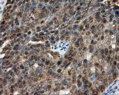 Immunohistochemistry-Paraffin: CUGBP1/CELF1 Antibody (OTI5B8) [NBP2-02343]