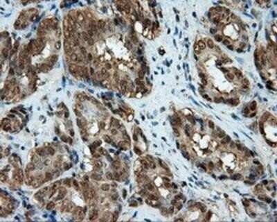Immunohistochemistry-Paraffin: CUGBP1/CELF1 Antibody (OTI5B8) [NBP2-02343]