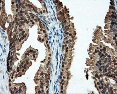 Immunohistochemistry-Paraffin: CUGBP1/CELF1 Antibody (OTI5B8) [NBP2-02343]