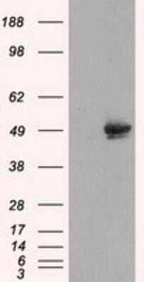 Western Blot: CUGBP1/CELF1 Antibody (OTI5B8) [NBP2-02343]