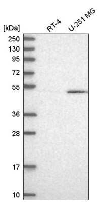 Western Blot: CUGBP1/CELF1 Antibody [NBP2-76536]