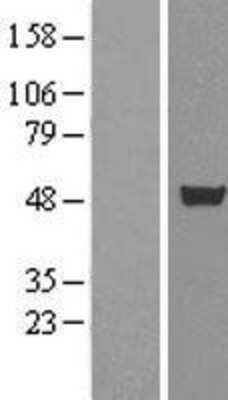 Western Blot: CUGBP1/CELF1 Overexpression Lysate [NBL1-09604]