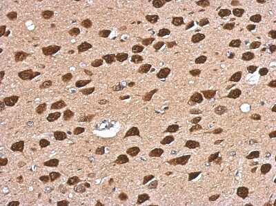 Immunohistochemistry-Paraffin: CUGBP2 Antibody [NBP2-16034]