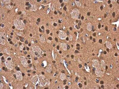 Immunohistochemistry-Paraffin: CUGBP2 Antibody [NBP2-16034]
