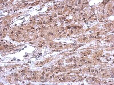 Immunohistochemistry-Paraffin: CUGBP2 Antibody [NBP2-16035]