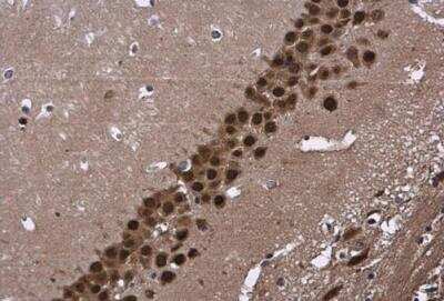 Immunohistochemistry-Paraffin: CUGBP2 Antibody [NBP2-16035]