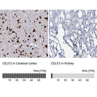 Immunohistochemistry-Paraffin: CUGBP2 Antibody [NBP2-48646]