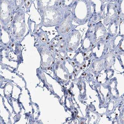 Immunohistochemistry-Paraffin: CUGBP2 Antibody [NBP2-48646]