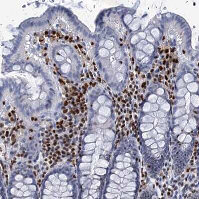 Immunohistochemistry-Paraffin: CUGBP2 Antibody [NBP2-48646]