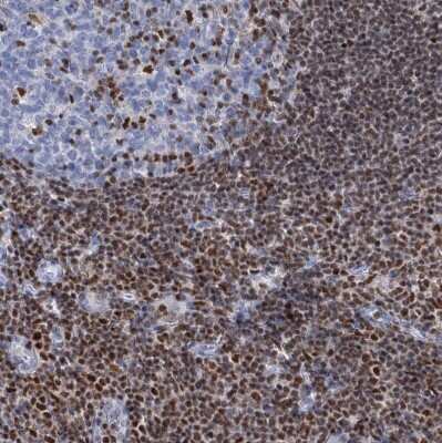 Immunohistochemistry-Paraffin: CUGBP2 Antibody [NBP2-48646]