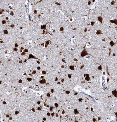 Immunohistochemistry-Paraffin: CUGBP2 Antibody [NBP2-48646]