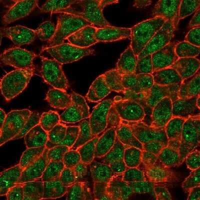 Immunocytochemistry/ Immunofluorescence: CUGBP2 Antibody (PCRP-CELF2-1E4) [NBP3-13841]