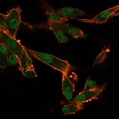 Immunocytochemistry/ Immunofluorescence: CUGBP2 Antibody (PCRP-CELF2-1E4) [NBP3-13841]