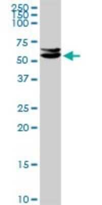 Western Blot: CUGBP2 Antibody [H00010659-D01P]