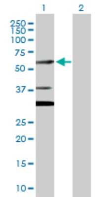 Western Blot: CUGBP2 Antibody [H00010659-D01P]