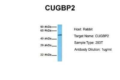 Western Blot: CUGBP2 Antibody [NBP1-57376]