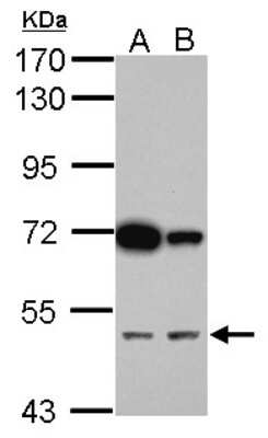 Western Blot: CUGBP2 Antibody [NBP2-16034]