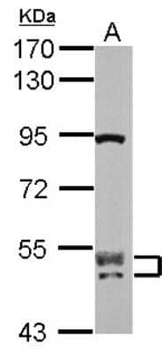 Western Blot: CUGBP2 Antibody [NBP2-16034]