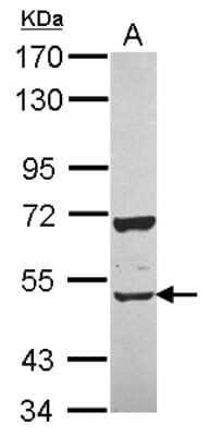 Western Blot: CUGBP2 Antibody [NBP2-16035]