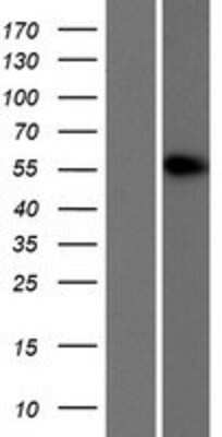 Western Blot: CUGBP2 Overexpression Lysate [NBP2-10403]