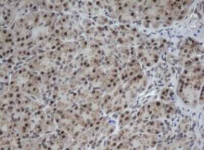 Immunohistochemistry: CUL4B Antibody (OTI1C4) [NBP2-45648]