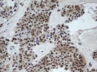 Immunohistochemistry: CUL4B Antibody (OTI1C4) [NBP2-45648]