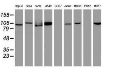 Western Blot: CUL4B Antibody (OTI1C4) [NBP2-45648]