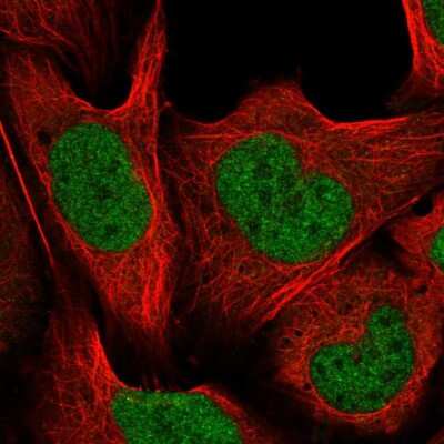 Immunocytochemistry/ Immunofluorescence: CUL4B Antibody [NBP2-56697]